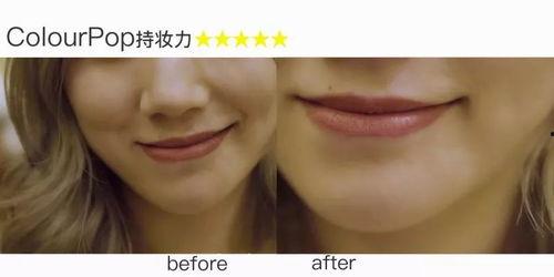 洋瓜尖耳洞化脓可以吃吗